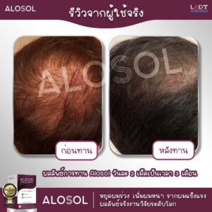 Alosol ผลิตภัณฑ์ดูแลเส้นผม