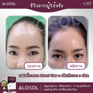 Alosol ผลิตภัณฑ์ดูแลเส้นผม