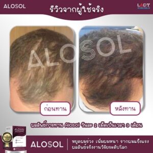 Alosol ผลิตภัณฑ์ดูแลเส้นผม