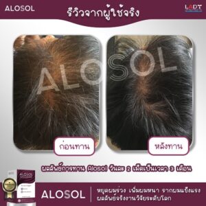 Alosol ผลิตภัณฑ์ดูแลเส้นผม