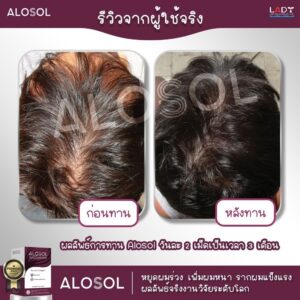 Alosol ผลิตภัณฑ์ดูแลเส้นผม