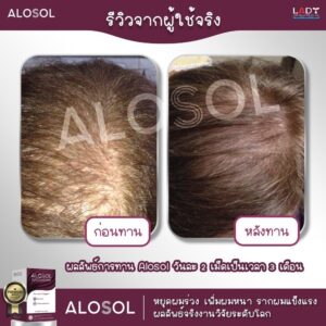 Alosol ผลิตภัณฑ์ดูแลเส้นผม