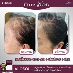 Alosol ผลิตภัณฑ์ดูแลเส้นผม