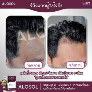 Alosol ผลิตภัณฑ์ดูแลเส้นผม